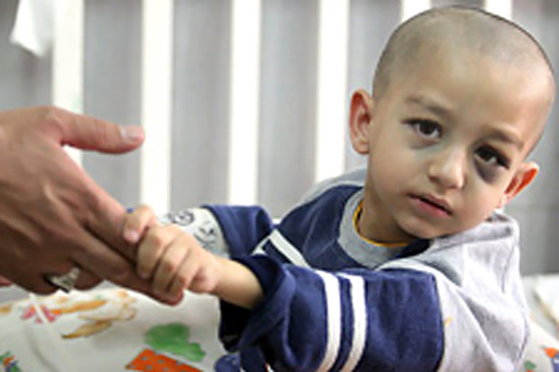 نبود سیستم جامع ثبت سرطان کودکان در کشور