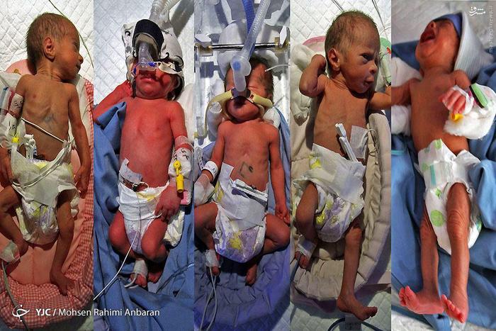 عکس/ تولد ۵ قلوها در مشهد