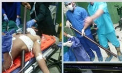 خارج‌کردن لوله ۲٫۵ متری از قفسه سینه کارگر ساختمانی+تصویر