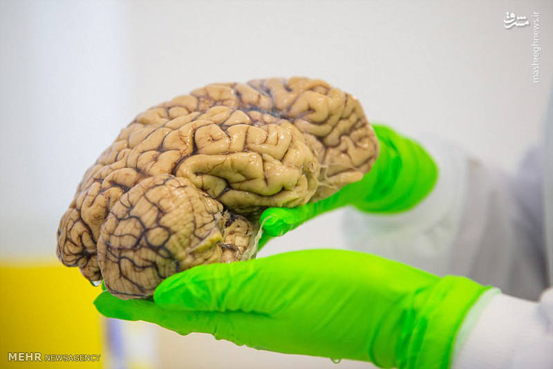 بانک مغز در انگلیس