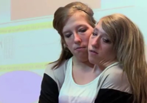 دوقلوهای به هم چسبیده‌ای که معلم مدرسه هستند + فیلم