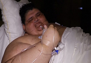 جراحی مرد ۵۹۰ کیلوگرمی برای کاهش وزن + فیلم