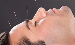 سوالات خود را از متخصص «طب سوزنی» بپرسید
