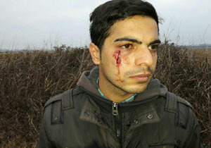 زخمی شدن محیط بان شهرستان نور  بر اثر حمله شکارچی متخلف+ عکس