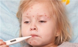 ۳ برابر شدن موارد ابتلا به سرخک در اروپا