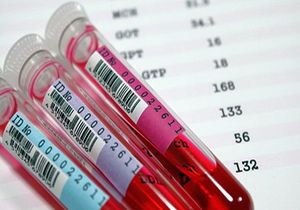 سهم هر ایرانی ۲۰ میلی لیتر خون! +فیلم