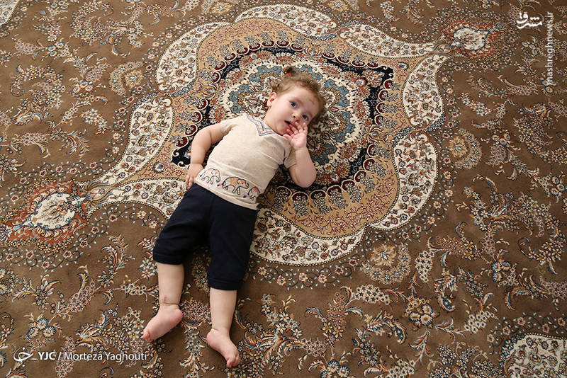 هزینه ۳میلیاردی درمان دختربچه خوزستانی