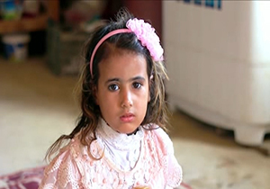 دختربچه‌ای با بیماری نادر پوستی + فیلم
