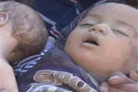 فیلم/ هر ۱۰ دقیقه یک کودک یمنی می میرد!