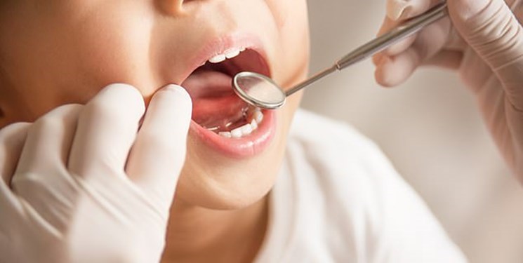 دندان‌های ۷۰۰هزار دانش‌آموز پایه ششمی عاری از پوسیدگی است