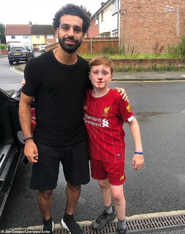 پسری که بینی خود را به خاطر محمد صلاح شکست